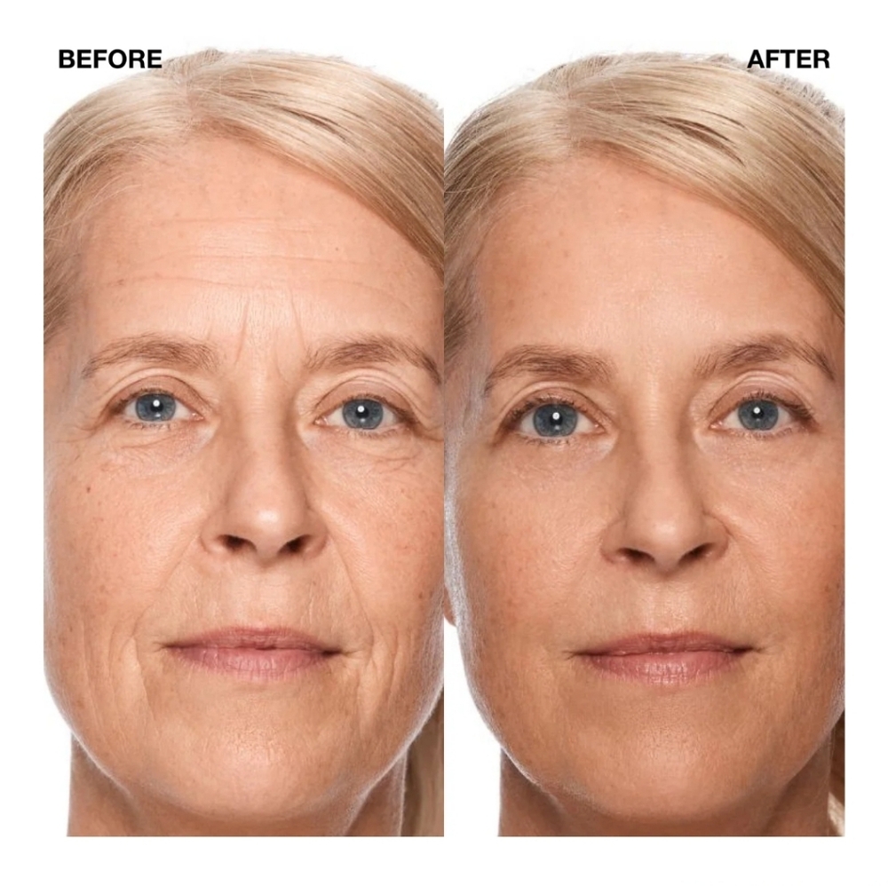 Liquid Facelift Wand - Silver & White - Picture 4 of 5